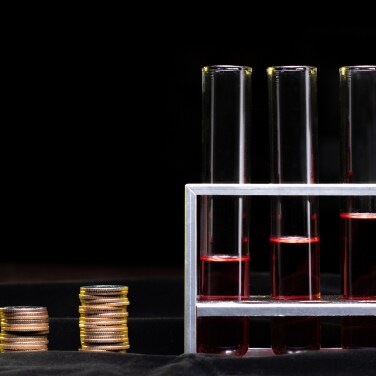 Tips for Managing Your Lab Budget Tips for Managing Your Lab Budget
